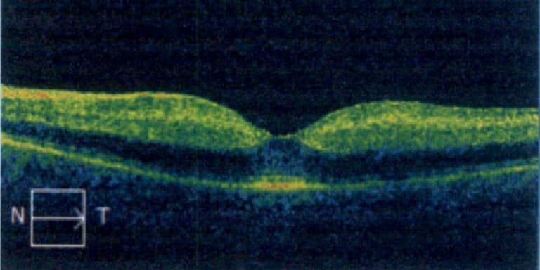 Ophthalmology Scan