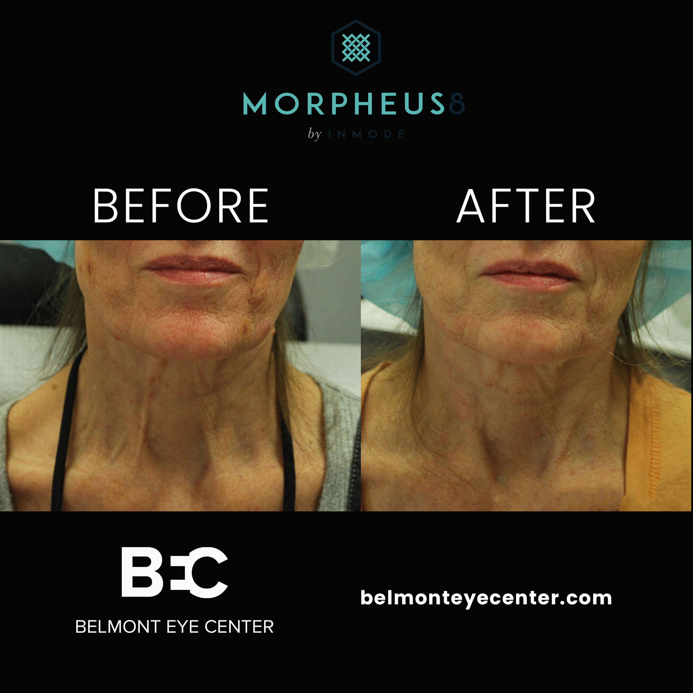 Before and After Treatment Images