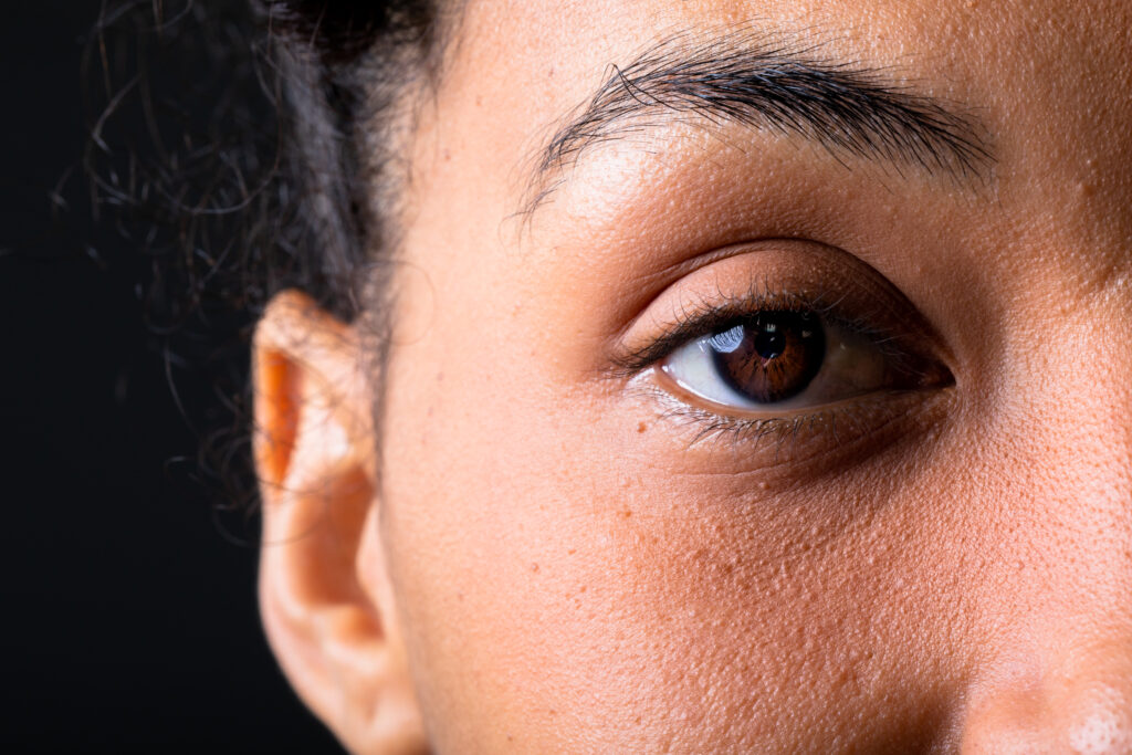 Understanding the Causes of Dry Eyes: Insights from Belmont Eye Center