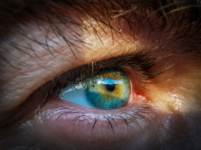 Close up of an eye