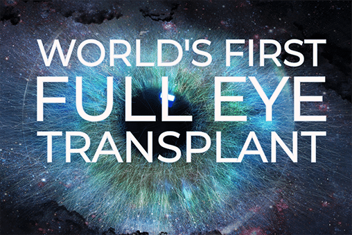 World's First Whole-Eye Transplant: A Breakthrough in Surgery, But Vision Remains Unattainable