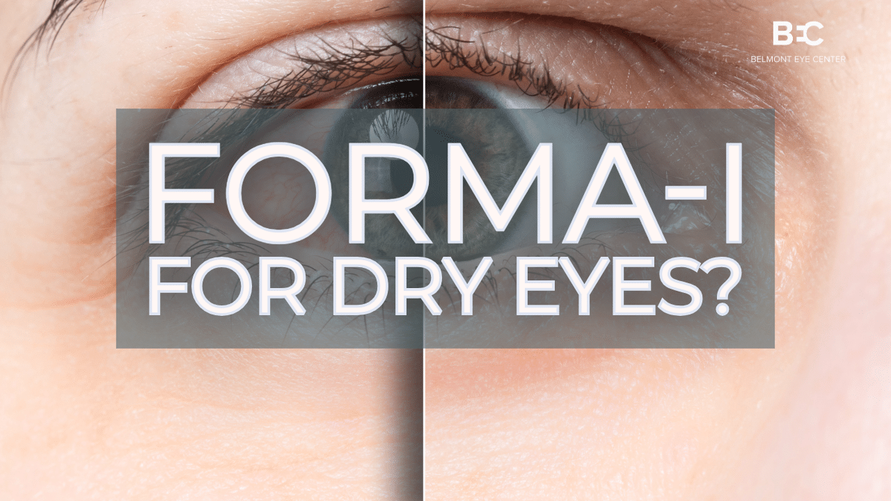 Forma-I for Dry Eyes: The Non-Invasive Treatment Everyone’s Talking About