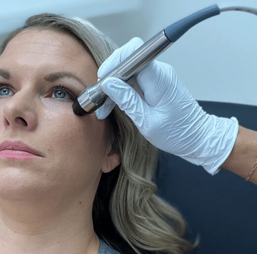 Clinician applying microdermabrasion near patient's eye