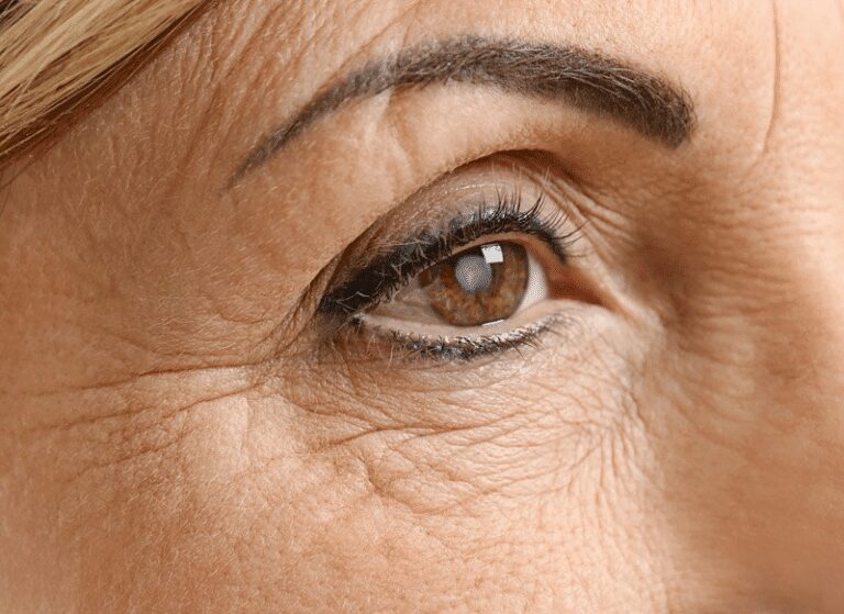 cataract prevention eye up close