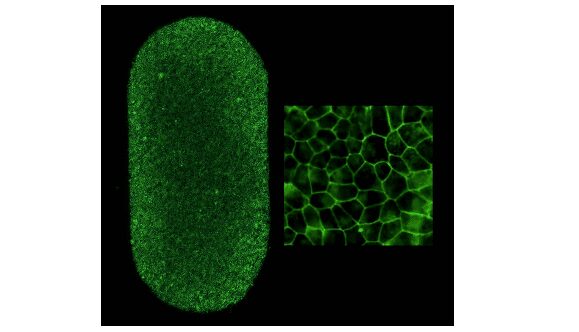 Green fluorescent cell monolayer and magnified mosaic