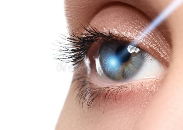 LASIK eye surgery concept