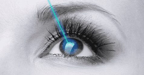 Eye receiving blue laser overlay illustration